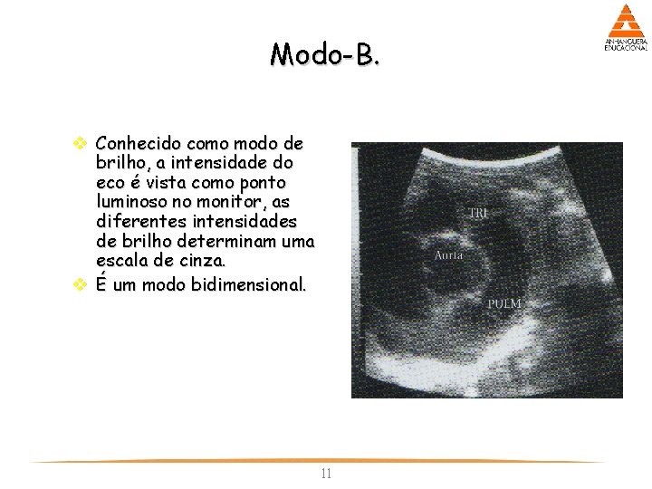 Modo-B. v Conhecido como modo de brilho, a intensidade do eco é vista como