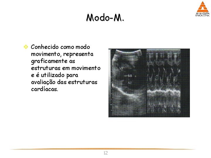 Modo-M. v Conhecido como modo movimento, representa graficamente as estruturas em movimento e é