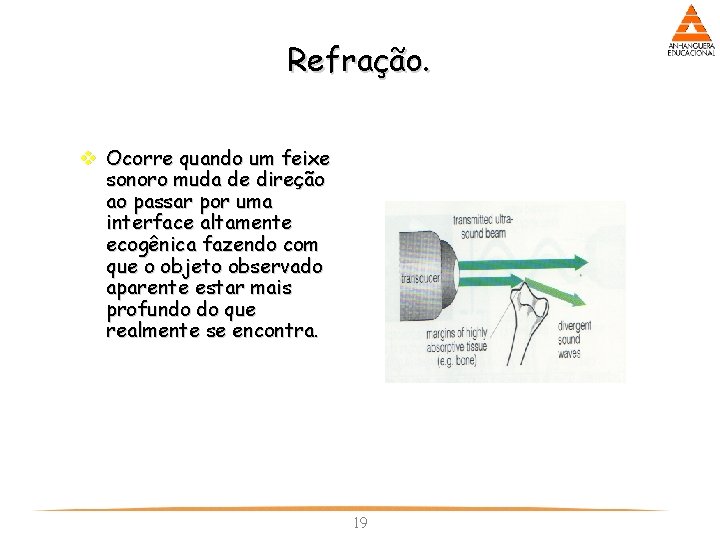 Refração. v Ocorre quando um feixe sonoro muda de direção ao passar por uma