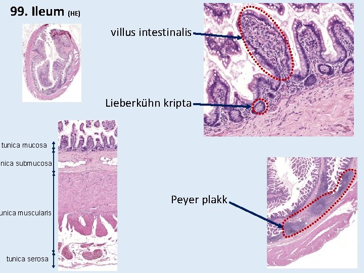 99. Ileum (HE) villus intestinalis Lieberkühn kripta tunica mucosa unica submucosa Peyer plakk unica