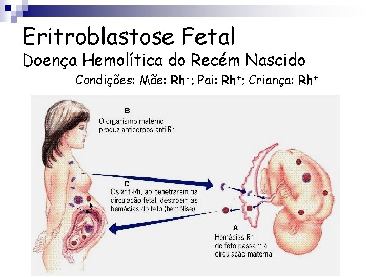 Eritroblastose Fetal Doença Hemolítica do Recém Nascido Condições: Mãe: Rh-; Pai: Rh+; Criança: Rh+