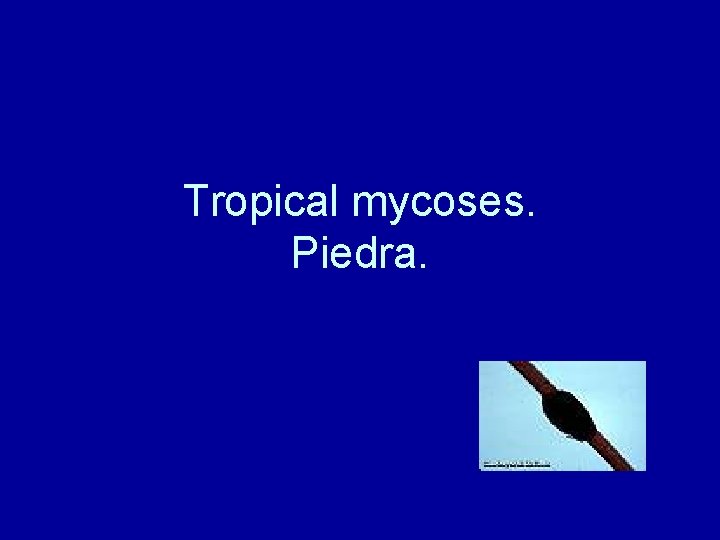 Tropical mycoses. Piedra. 