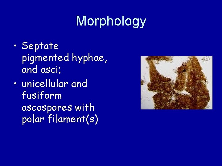 Morphology • Septate pigmented hyphae, and asci; • unicellular and fusiform ascospores with polar