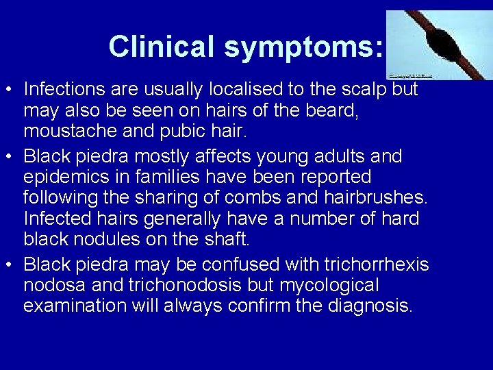 Clinical symptoms: • Infections are usually localised to the scalp but may also be