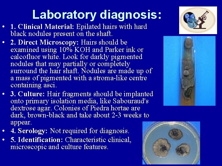 Laboratory diagnosis: • 1. Clinical Material: Epilated hairs with hard black nodules present on