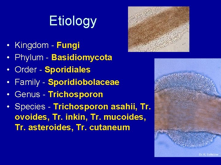 Etiology • • • Kingdom - Fungi Phylum - Basidiomycota Order - Sporidiales Family
