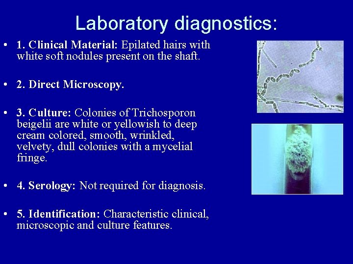 Laboratory diagnostics: • 1. Clinical Material: Epilated hairs with white soft nodules present on