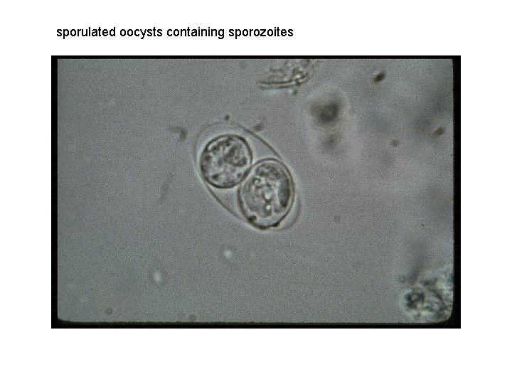 sporulated oocysts containing sporozoites 