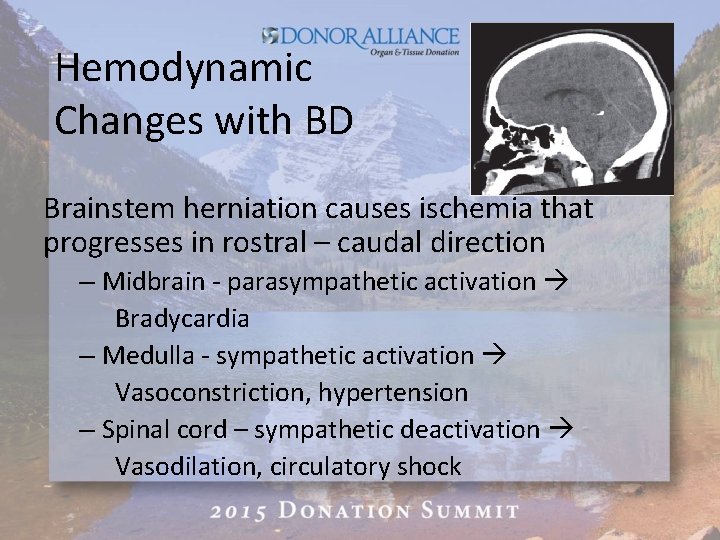 Hemodynamic Changes with BD Brainstem herniation causes ischemia that progresses in rostral – caudal