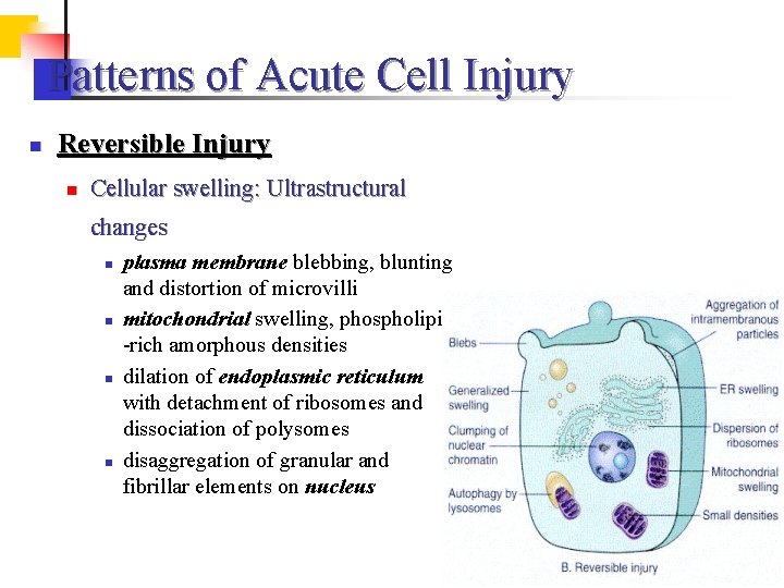 Patterns of Acute Cell Injury n Reversible Injury n Cellular swelling: Ultrastructural changes n