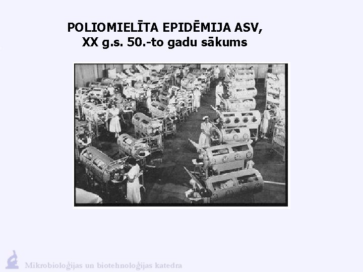 POLIOMIELĪTA EPIDĒMIJA ASV, XX g. s. 50. -to gadu sākums 