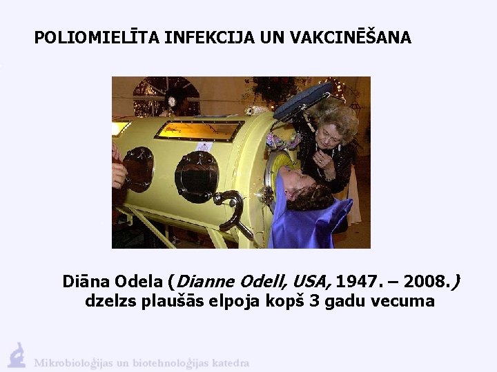 POLIOMIELĪTA INFEKCIJA UN VAKCINĒŠANA Diāna Odela (Dianne Odell, USA, 1947. – 2008. ) dzelzs