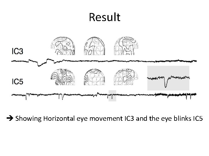 Result Showing Horizontal eye movement IC 3 and the eye blinks IC 5 