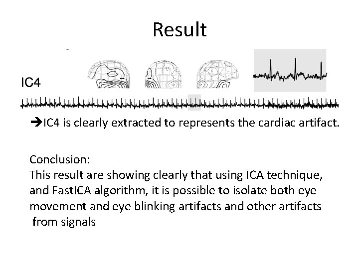 Result IC 4 is clearly extracted to represents the cardiac artifact. Conclusion: This result