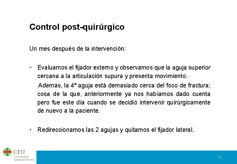 Control post-quirúrgico Un mes después de la intervención: • Evaluamos el fijador externo y