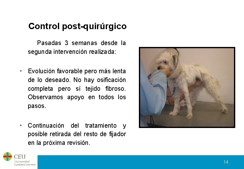 Control post-quirúrgico Pasadas 3 semanas desde la segunda intervención realizada: • Evolución favorable pero