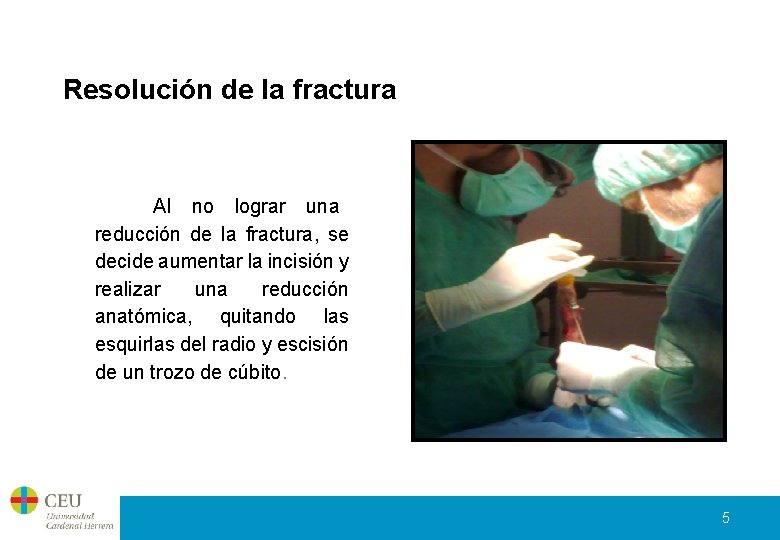 Resolución de la fractura Al no lograr una reducción de la fractura, se decide