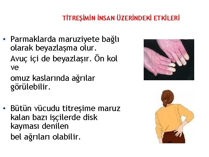 TİTREŞİMİN İNSAN ÜZERİNDEKİ ETKİLERİ • Parmaklarda maruziyete bağlı olarak beyazlaşma olur. Avuç içi de