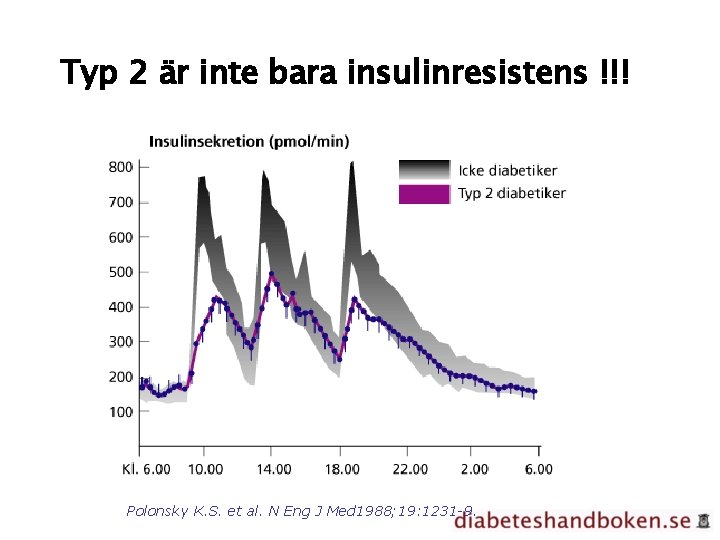 Typ 2 är inte bara insulinresistens !!! Polonsky K. S. et al. N Eng