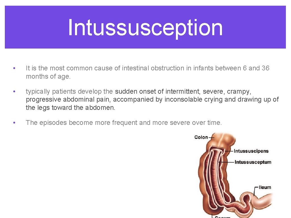 Intussusception • It is the most common cause of intestinal obstruction in infants between Intussusception • It is the most common cause of intestinal obstruction in infants between
