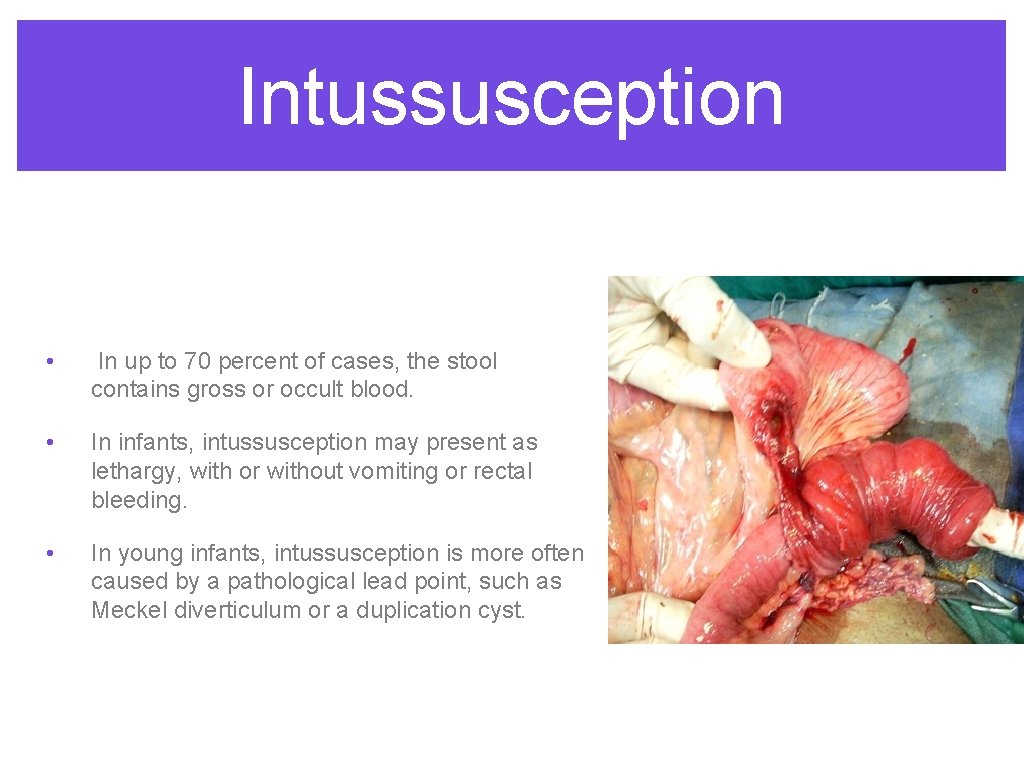 Intussusception • In up to 70 percent of cases, the stool contains gross or Intussusception • In up to 70 percent of cases, the stool contains gross or