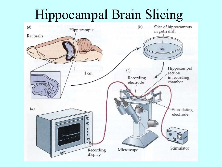 Hippocampal Brain Slicing 