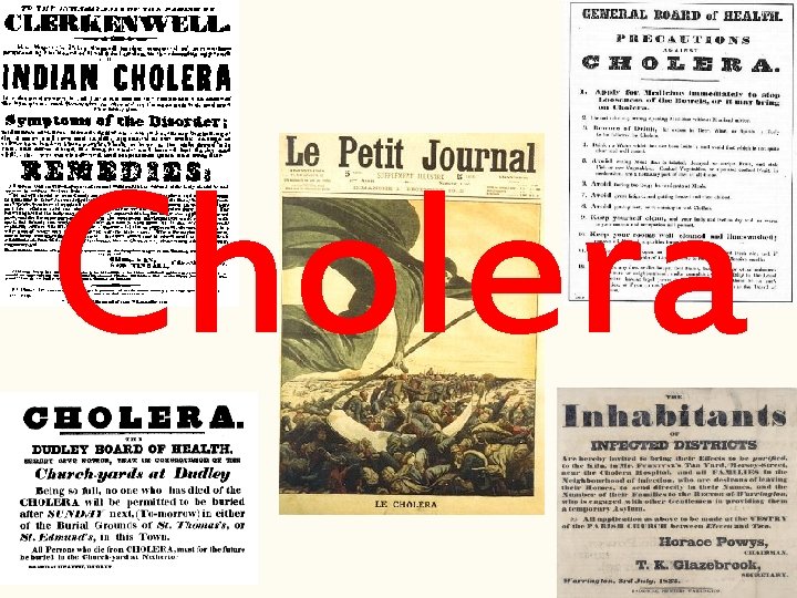 Cholera 