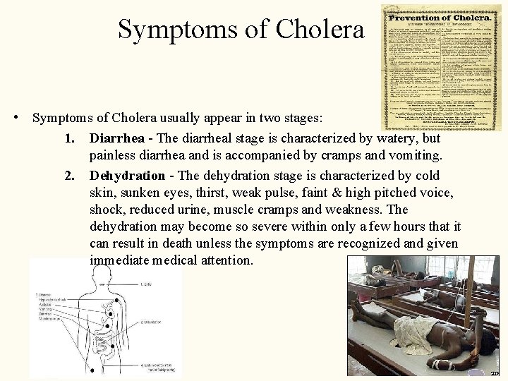 Symptoms of Cholera • Symptoms of Cholera usually appear in two stages: 1. Diarrhea