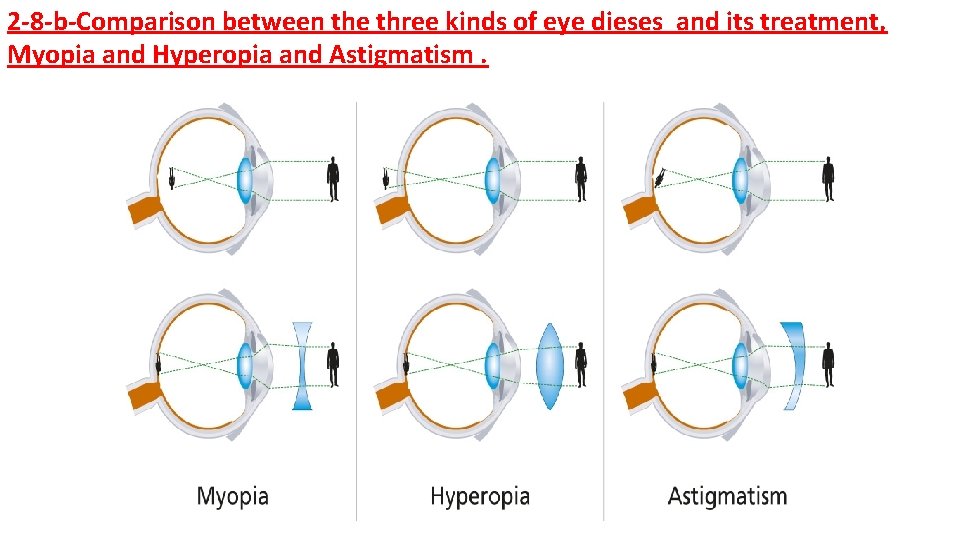 hipermetropie cu astigmatism ocular fly agaric pentru tratamentul vederii