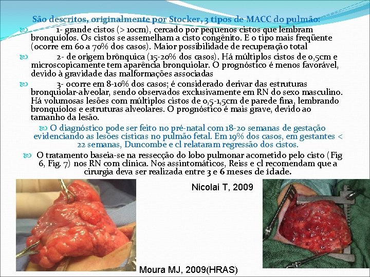 São descritos, originalmente por Stocker, 3 tipos de MACC do pulmão: 1 - grande São descritos, originalmente por Stocker, 3 tipos de MACC do pulmão: 1 - grande