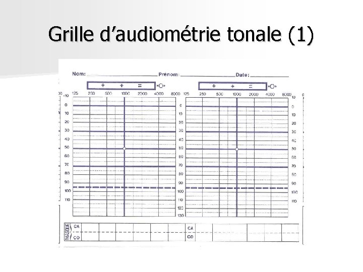Grille d’audiométrie tonale (1) Grille d’audiométrie tonale (1)