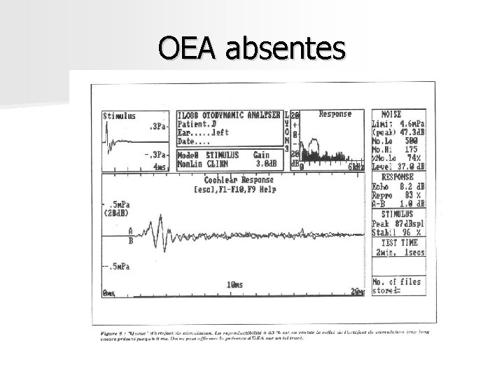 OEA absentes OEA absentes