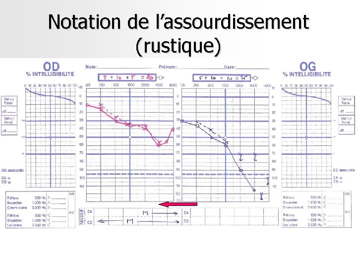 Notation de l’assourdissement (rustique) Notation de l’assourdissement (rustique)