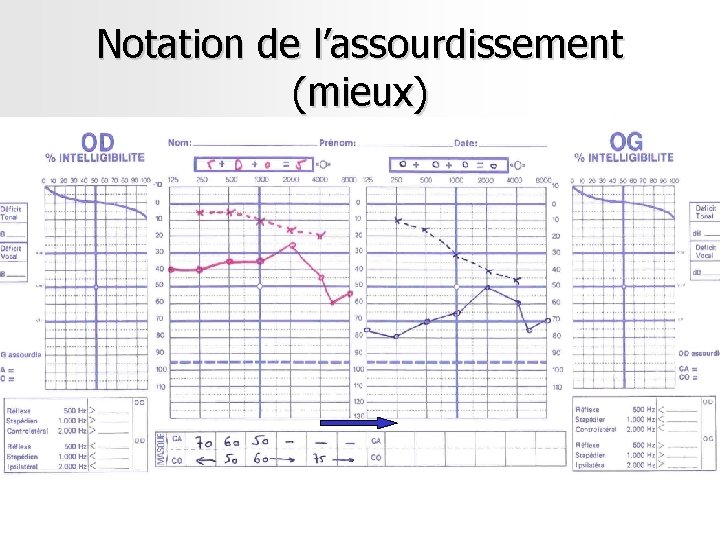 Notation de l’assourdissement (mieux) Notation de l’assourdissement (mieux)