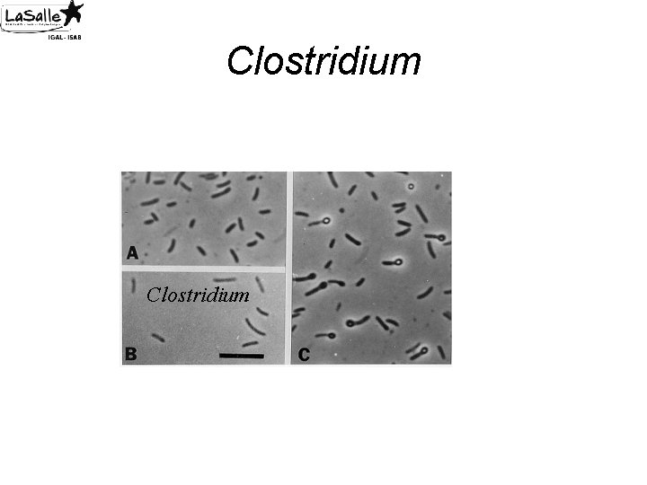 Clostridium 