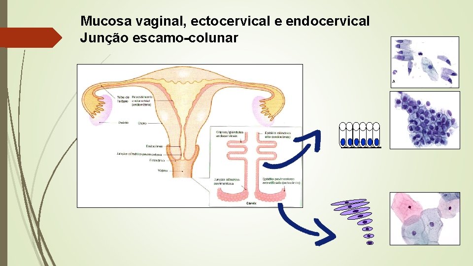 Mucosa vaginal, ectocervical e endocervical Junção escamo-colunar 