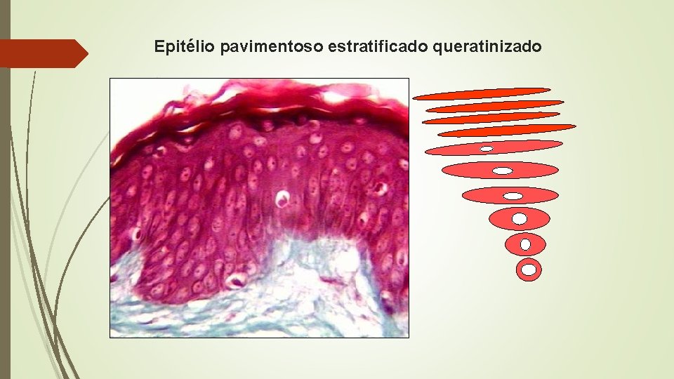 Epitélio pavimentoso estratificado queratinizado 