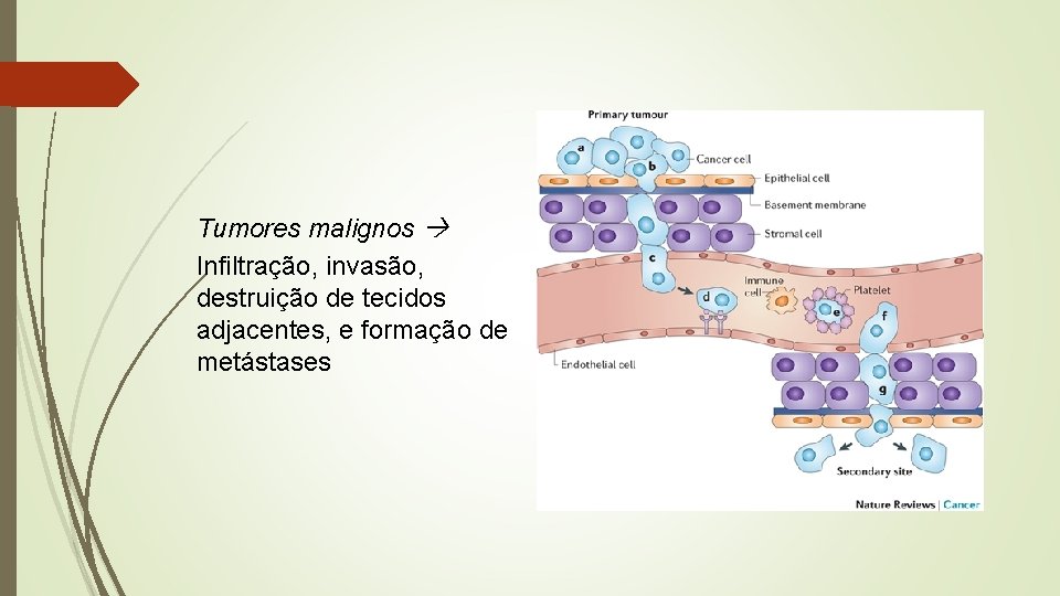 Tumores malignos Infiltração, invasão, destruição de tecidos adjacentes, e formação de metástases 