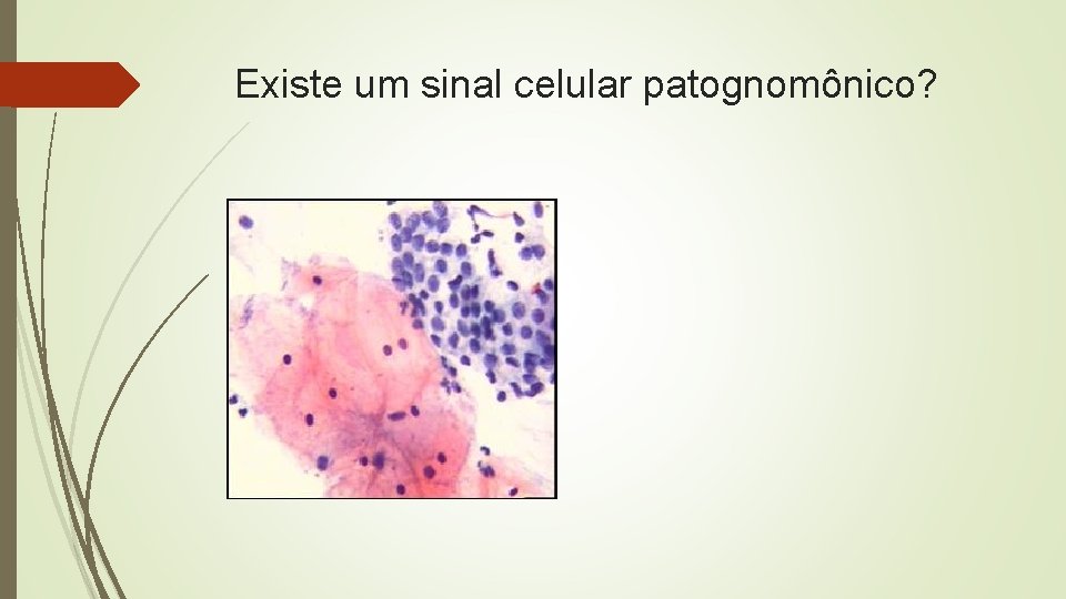 Existe um sinal celular patognomônico? 
