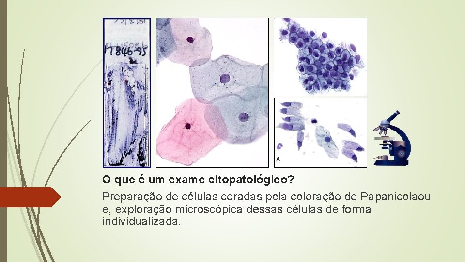 O que é um exame citopatológico? Preparação de células coradas pela coloração de Papanicolaou