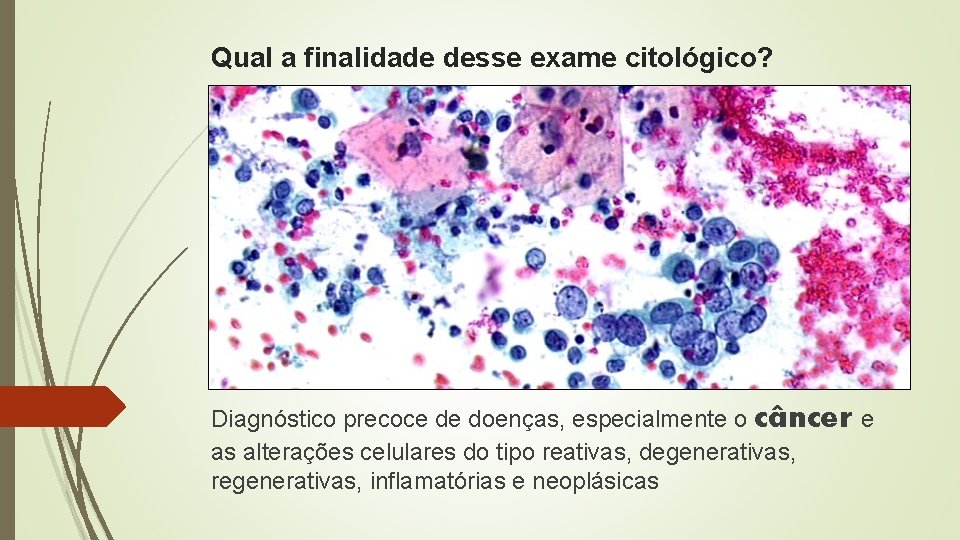 Qual a finalidade desse exame citológico? Diagnóstico precoce de doenças, especialmente o câncer e