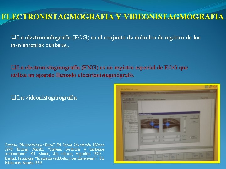 ELECTRONISTAGMOGRAFIA Y VIDEONISTAGMOGRAFIA q. La electrooculografía (EOG) es el conjunto de métodos de registro