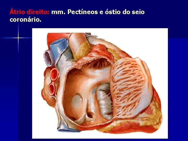 Átrio direito: mm. Pectíneos e óstio do seio coronário. 