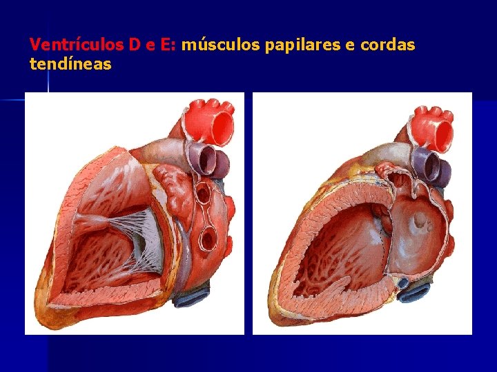 Ventrículos D e E: músculos papilares e cordas tendíneas 