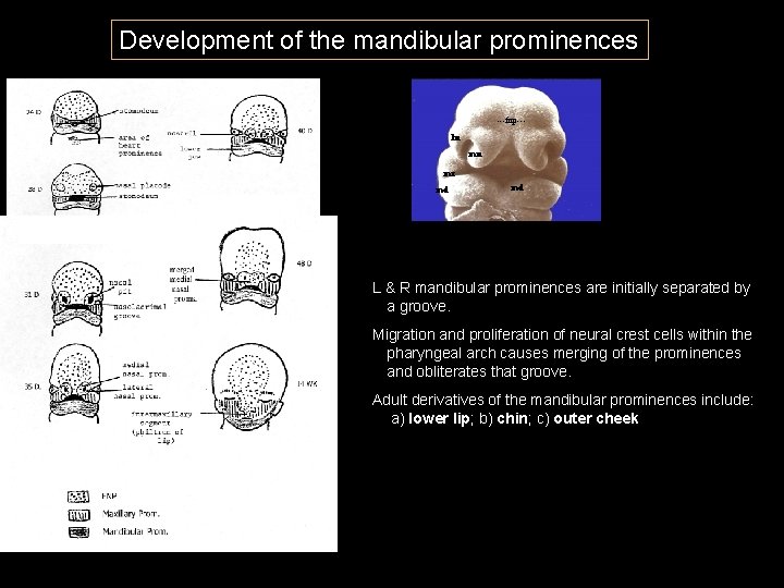 Development of the mandibular prominences ---fnp--ln mn mx md md L & R mandibular