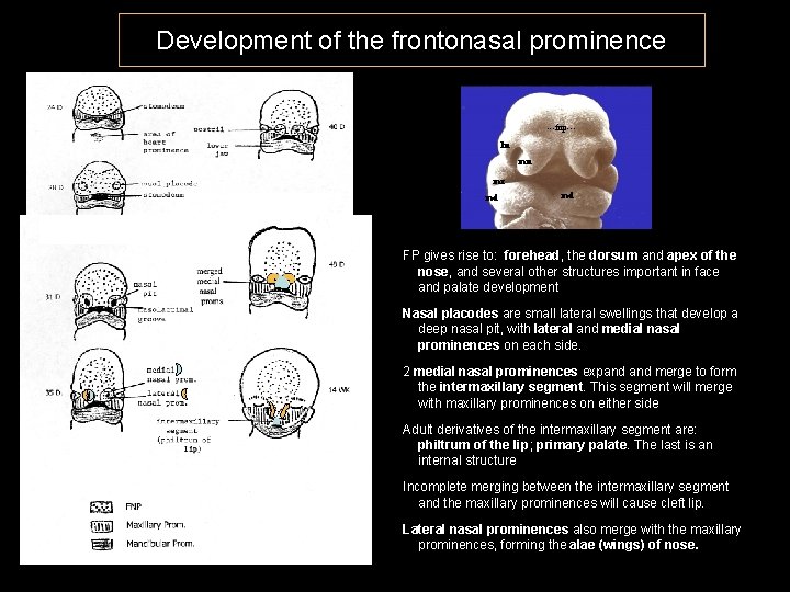 Development of the frontonasal prominence ---fnp--ln mn mx md md FP gives rise to: