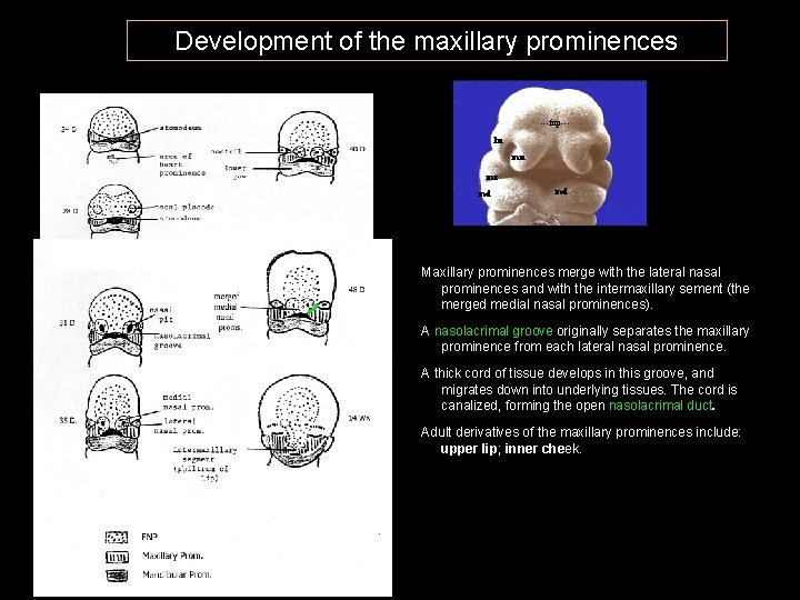 Development of the maxillary prominences ---fnp--ln mn mx md md Maxillary prominences merge with