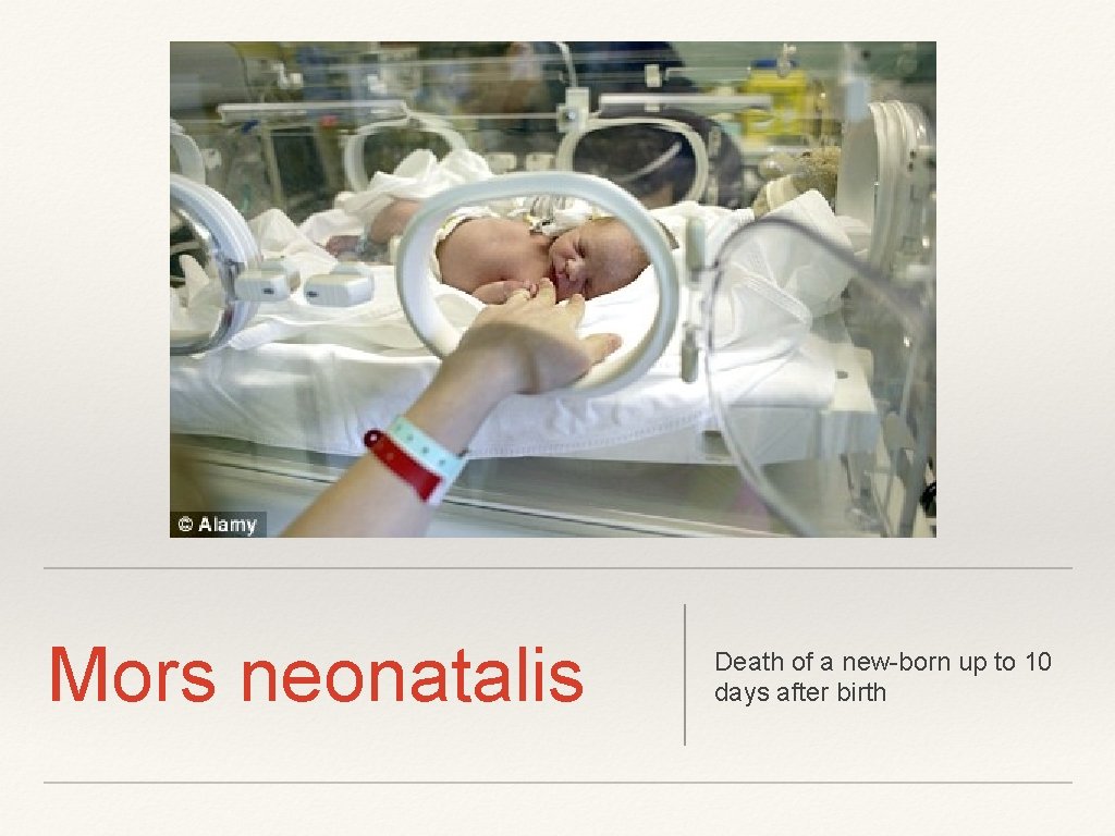 Mors neonatalis Death of a new-born up to 10 days after birth 