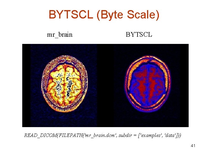 BYTSCL (Byte Scale) mr_brain BYTSCL READ_DICOM(FILEPATH('mr_brain. dcm', subdir = ['examples', 'data'])) 41 