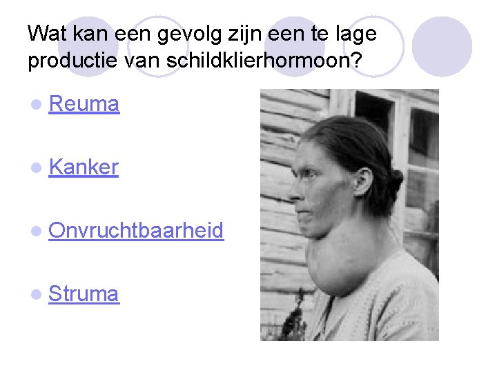 Wat kan een gevolg zijn een te lage productie van schildklierhormoon? l Reuma l